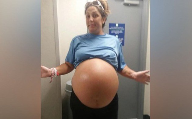 Під час вагітності її живіт досяг величезних розмірів, а коли дитина народилася, були здивовані ВСІ!