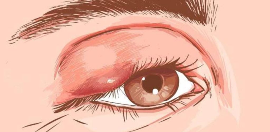 Очі – дзеркало здоров’я: 8 сигналів, за допомогою яких очі попереджають про проблеми зі здоров’ям! Зверни увагу!￼